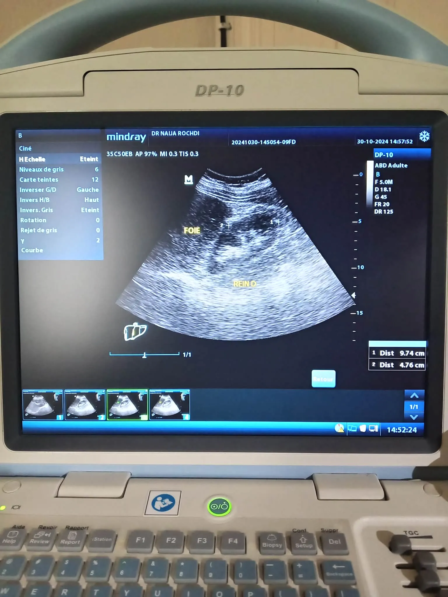 Écho Mindray DP‑10 بحالة ممتازة مع Chariot وSonde Convex 2–6 MHz