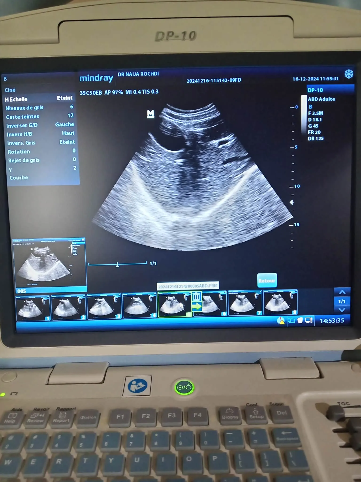 Écho Mindray DP‑10 بحالة ممتازة مع Chariot وSonde Convex 2–6 MHz